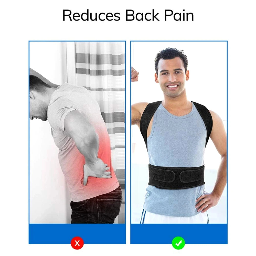 Adjustable Back &amp; Shoulder Posture Corrector Brace – Unisex