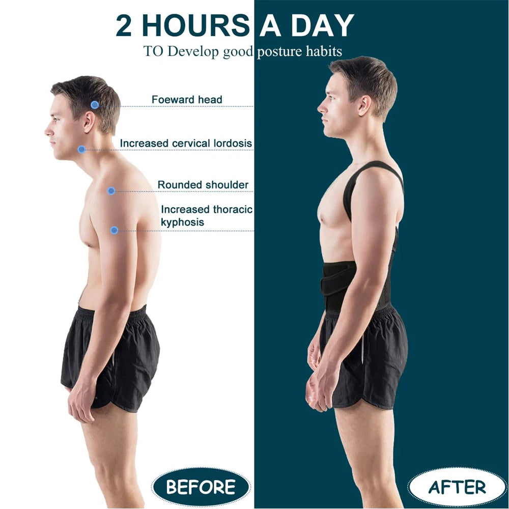 Adjustable Back &amp; Shoulder Posture Corrector Brace – Unisex